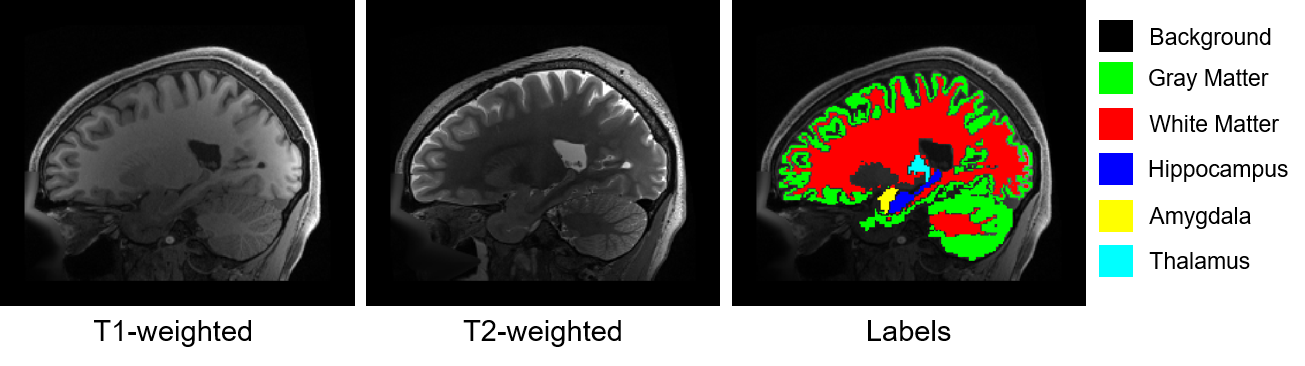 T1-weighted, T2-weighted, and segmented sagittal slices of a human brain