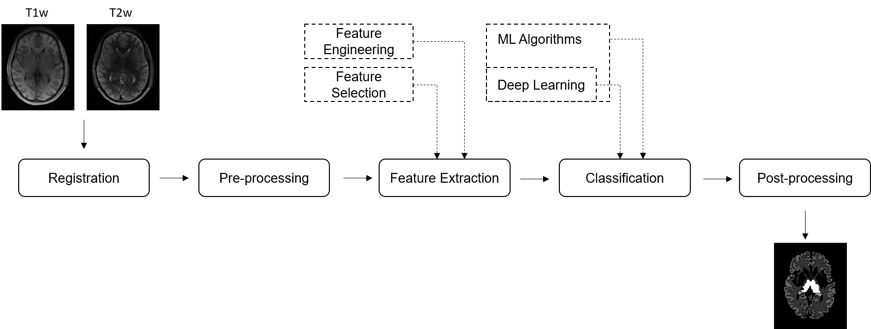 The MIA Lab pipeline, from pre-processing to evaluation